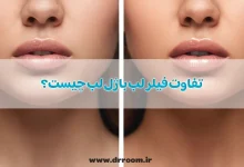 تفاوت فیلر لب با ژل لب چیست؟