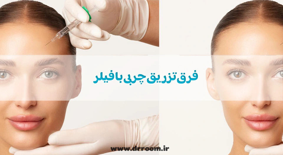 فرق تزریق چربی با فیلر؛ کدام بهتر است؟