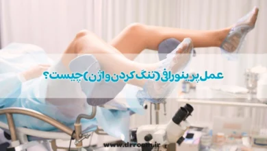 عمل پرینورافی(تنگ کردن واژن) چیست؟