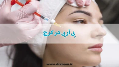 پی آر پی در کرج