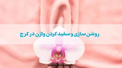 روشن سازی و سفید کردن واژن در کرج؛ بررسی هزینه 1404