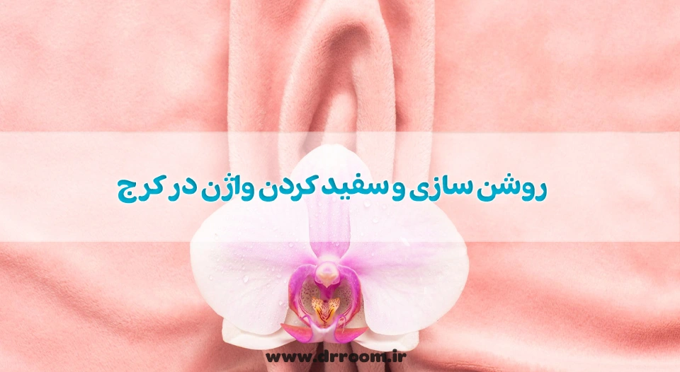 روشن سازی و سفید کردن واژن در کرج؛ بررسی هزینه 1404