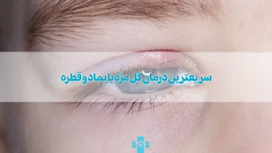 سریعترین درمان گل مژه