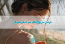 10 درمان سریع آفتاب سوختگی صورت و تیرگی پوست